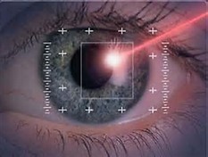 Does Laser Vision Correction hurt?